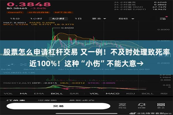 股票怎么申请杠杆交易 又一例！不及时处理致死率近100%！这种“小伤”不能大意→